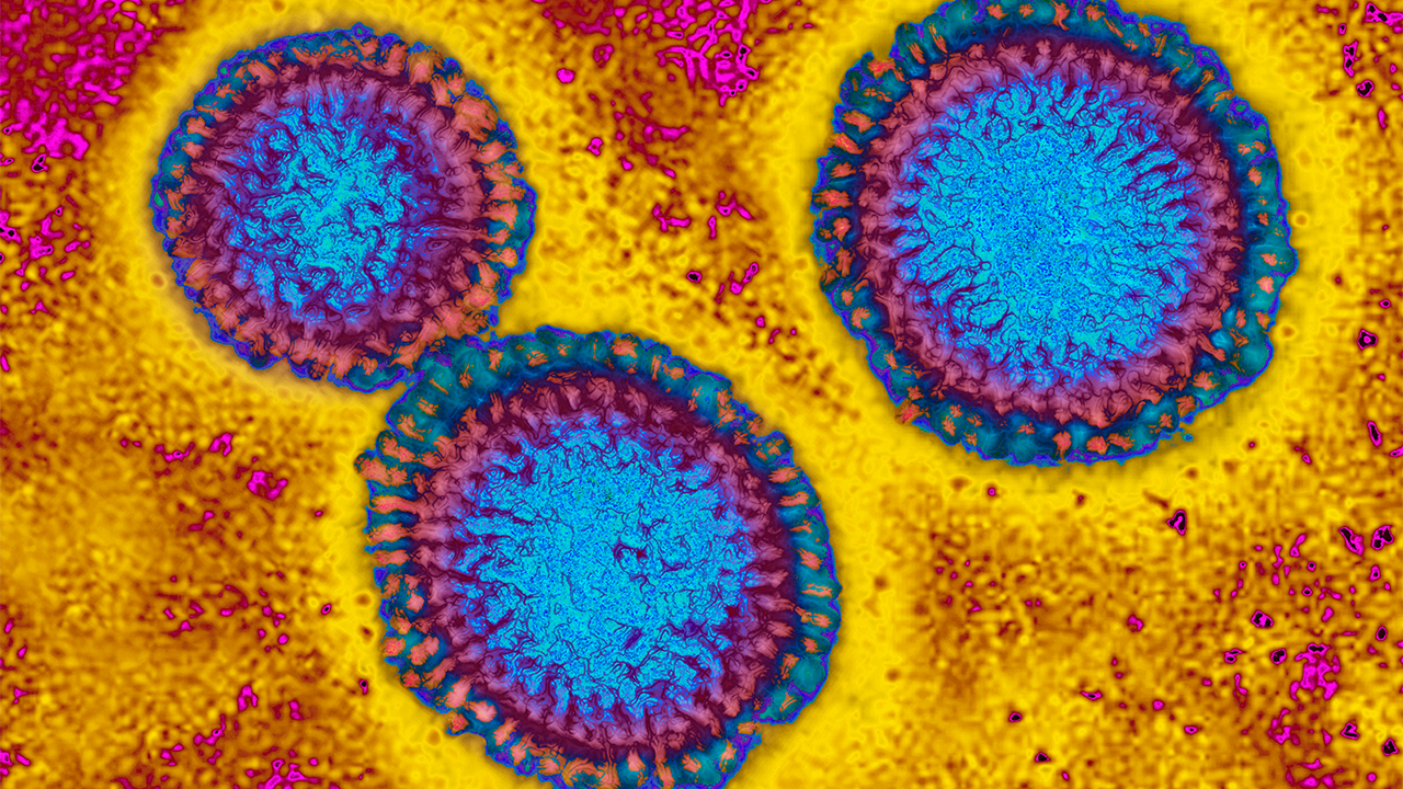 Flu hospitalizations 'slightly higher' than usual, officials urge vaccinations — FOX 9, Minnetonka Health news